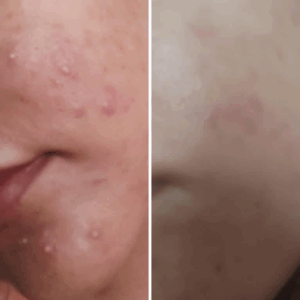 Nirvana Botanics Vitamin C + E Serum 15ml | Glowing, Anti Acne & Dark Spot Removal